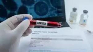 Mpox Test Kits