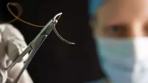 Surgery