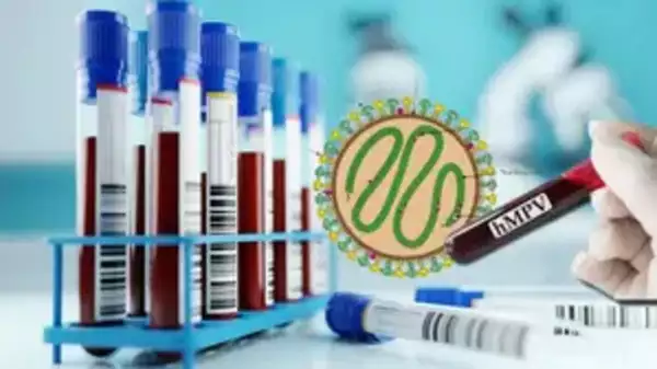 HMPV Infection