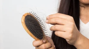 Hair Fall